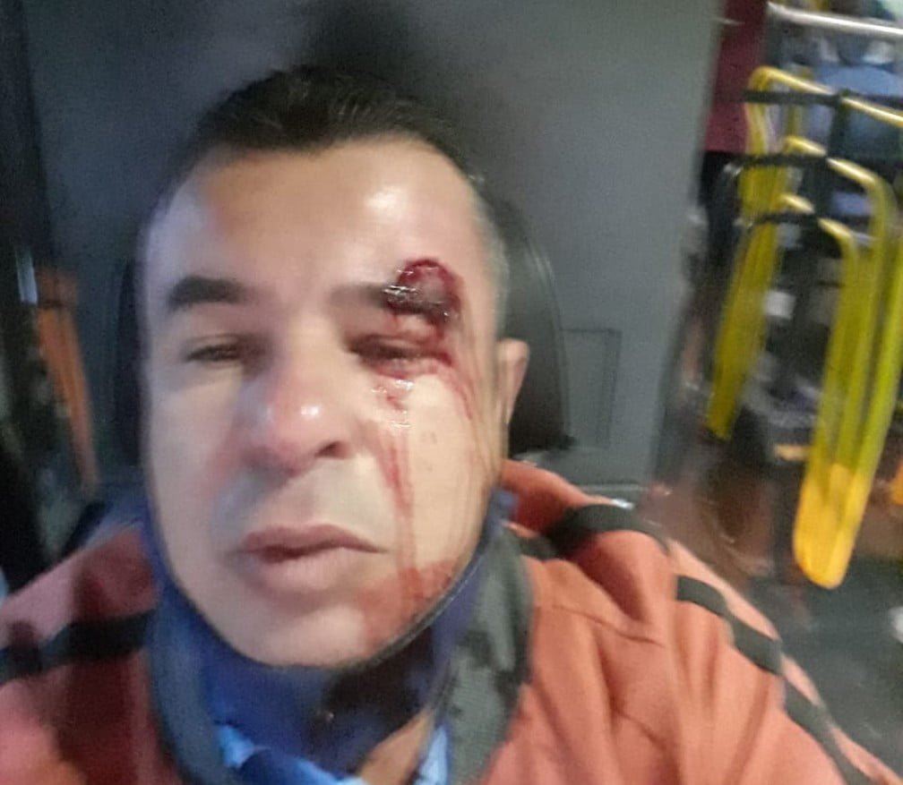 Motorista de ônibus é agredido em BH após exigir uso de máscara 2 motorista onibus